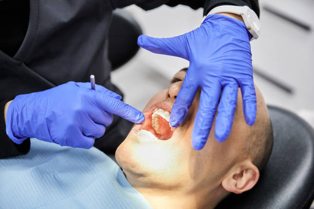Best Emergency Tooth Extraction in Georgetown, OH