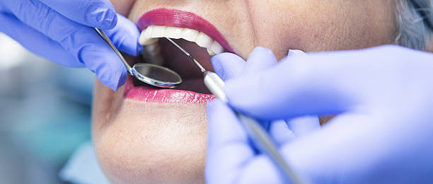 Best Emergency Treatment for Dental Infections or Abscesses in Georgetown, OH